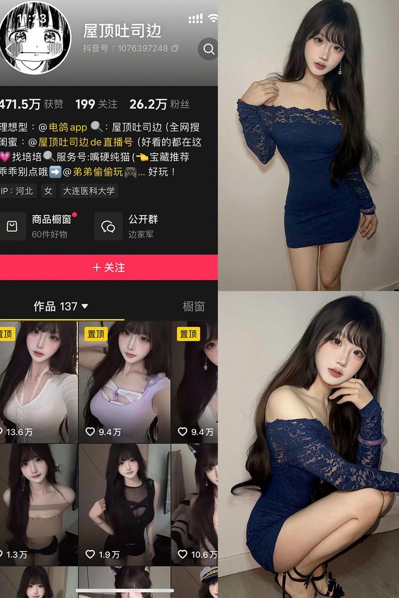 屋顶吐司边 – 微密圈/岛遇等写真&视频合集【持续更新中】-1